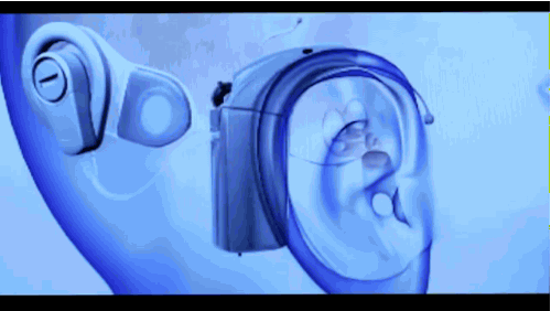 医学 神经科学 耳朵 听力