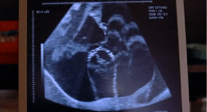 孕妇 怀孕 胎儿 搞笑 影像