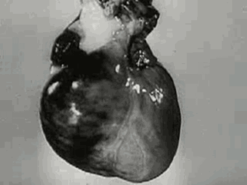 器官 动态图 心脏 肺