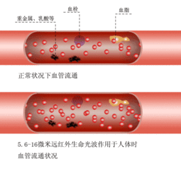 细菌 红色 血管 黑色