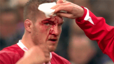 男子 踢球 受伤 流血