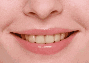 牙齿 嘴唇 微笑 健康