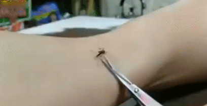 蚊子 在手上 剪刀 反应快